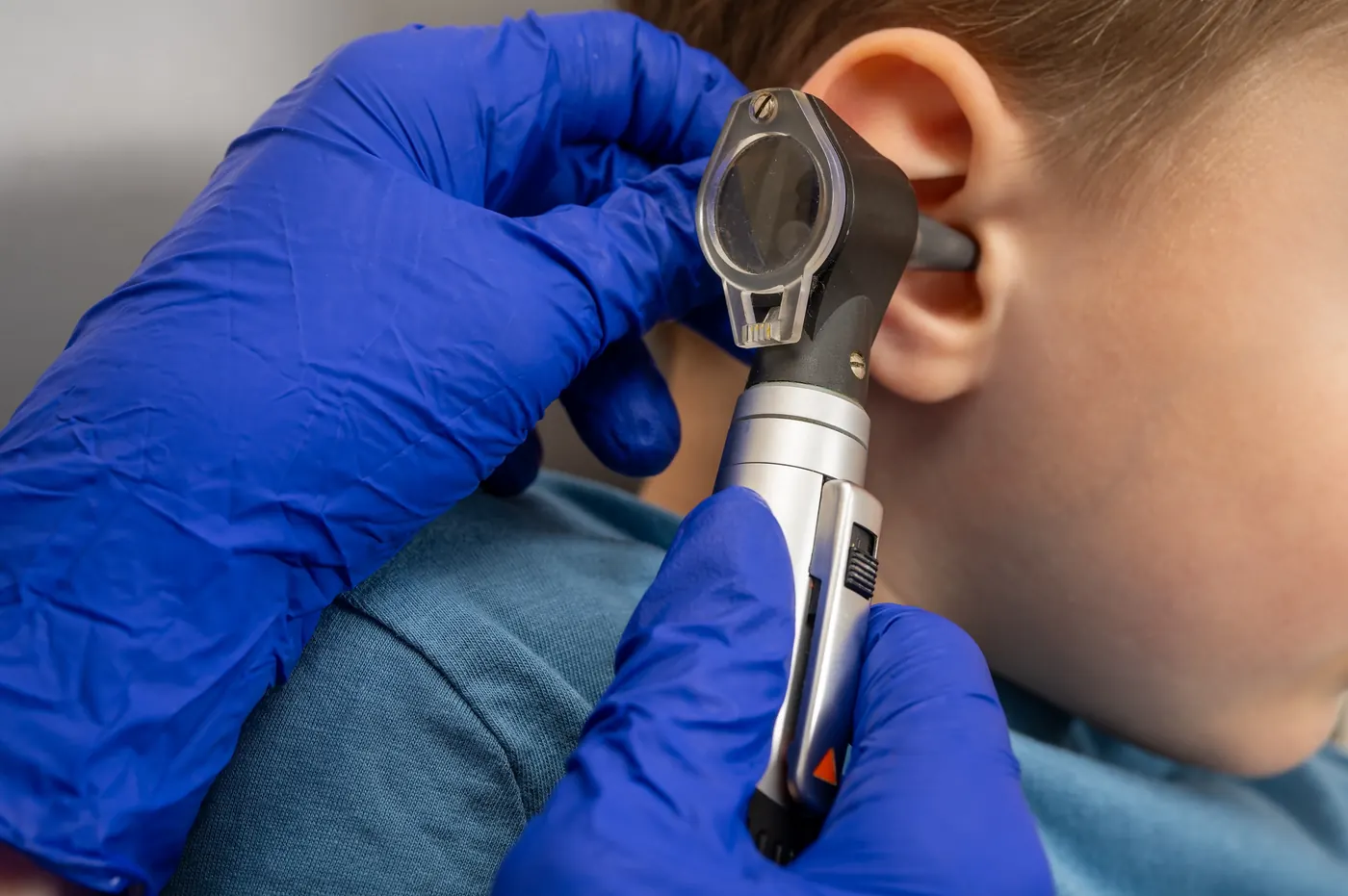 Clinician wearing blue gloves examining a child's ear with an otoscope